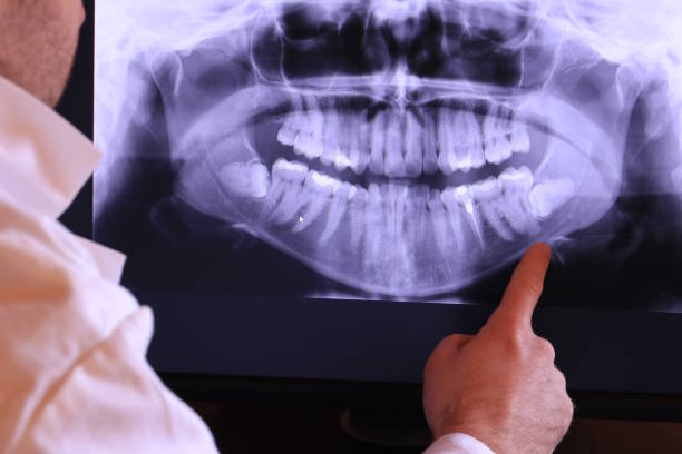 Best Walk-In Emergency Dentist in Limestone, IL