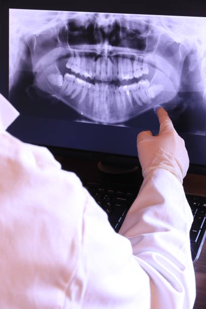 Best Walk-In Emergency Dentist in Limestone, IL