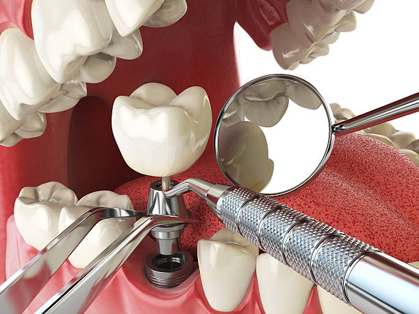 Best Emergency Dental Care for Trauma or Injury in Limestone, IL