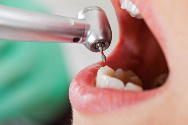 Best Pediatric Emergency Dentist in Limestone, IL